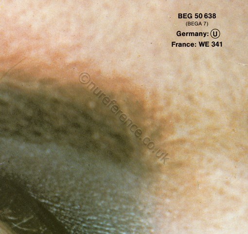 BEG 50 638 Cover Detail.