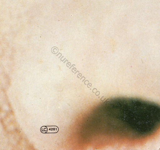 BEG 50 638 Back Cover Detail 1.